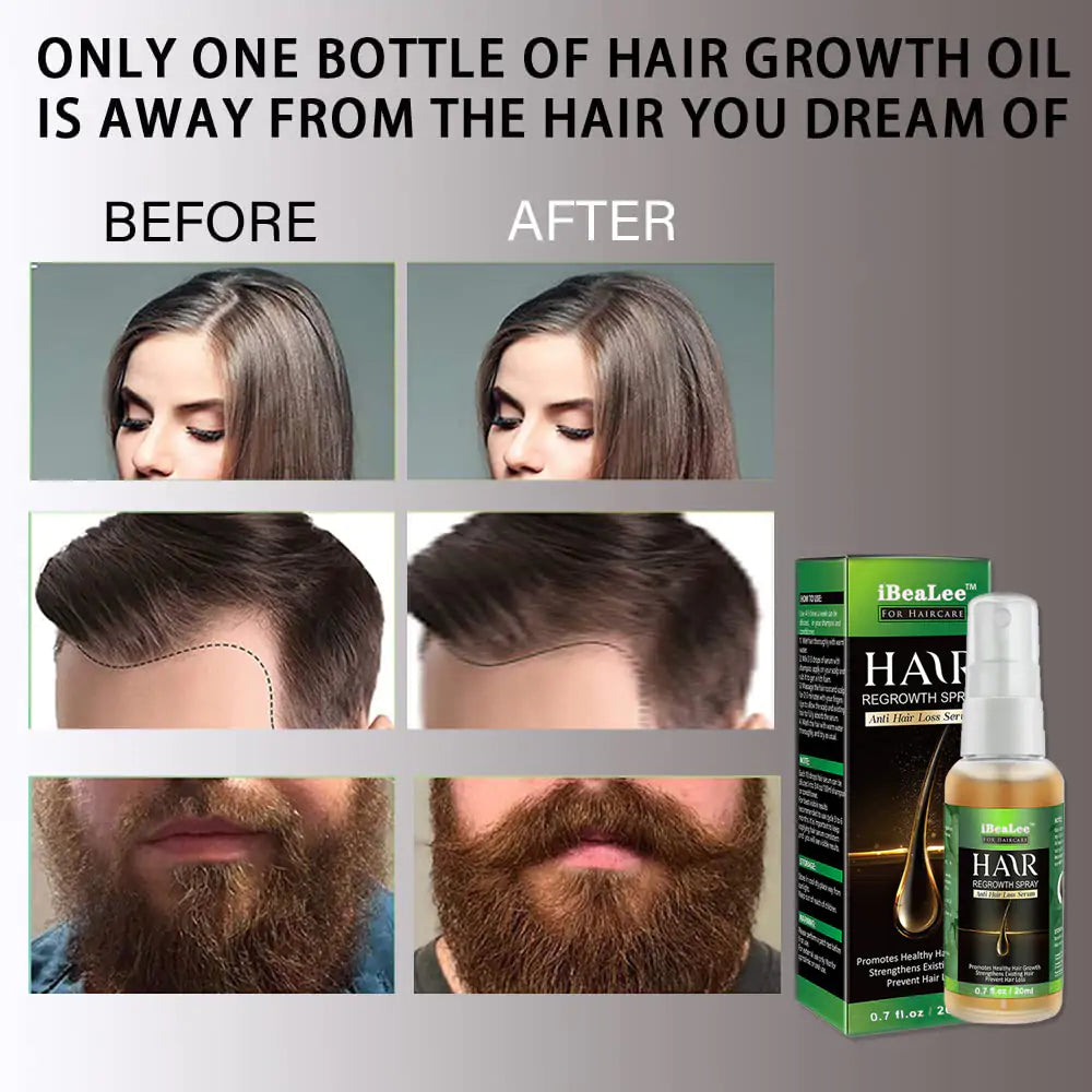 Hair Growth Spray Ginger